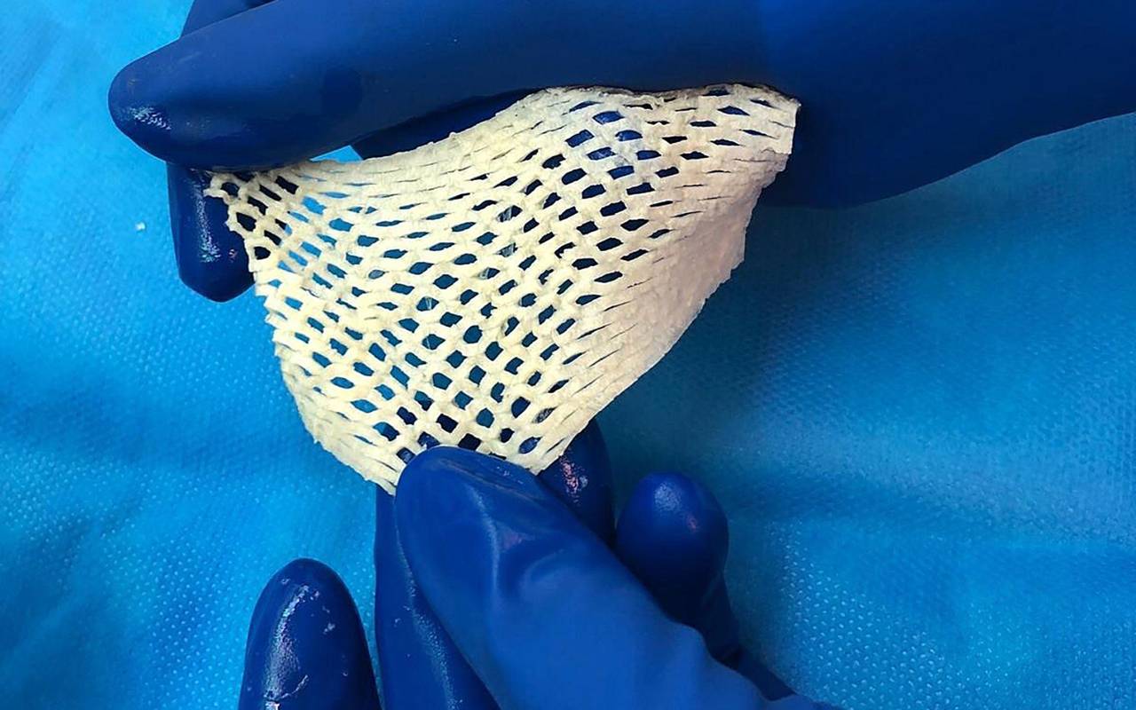 Fischhaut zur Behandlung von großen Wunden