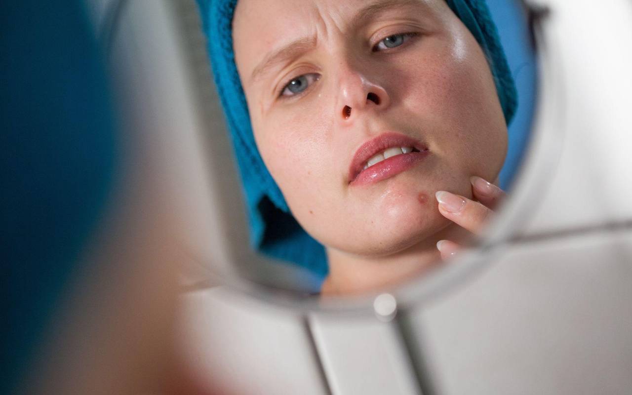 Frau betrachtet einen Pickel im Spiegel