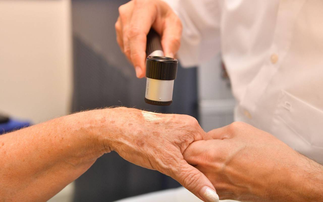 Dermatologe untersucht Altersflecken auf der Hand einer Frau