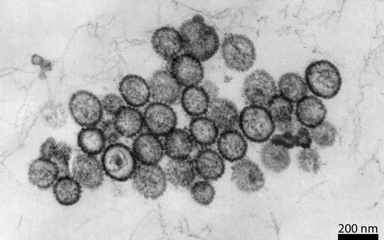 Hantavirus