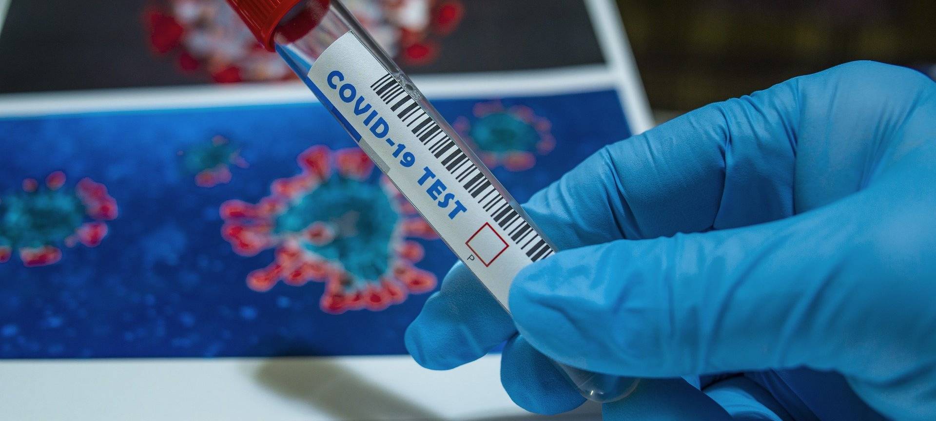 Regelmäßige Corona-Tests für Pflegemitarbeiter